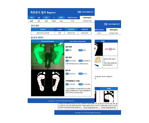AI 족부분석 결과를 정리한 디지털 족부 분석 리포트 예시